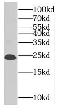 RAB8B Rabbit Polyclonal Antibody