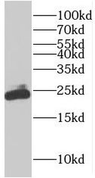 RAB9A Antibody