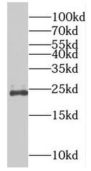 RAB9B Antibody