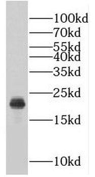 RABAC1 Antibody