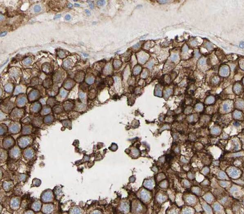 RBSN Antibody