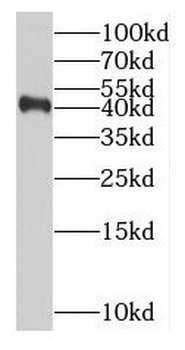 RABEPK Antibody