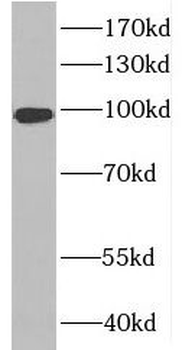 RABGAP1L Antibody