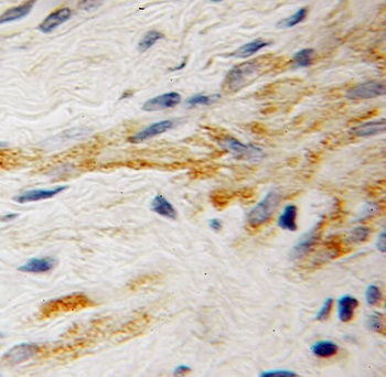 RABGEF1 Antibody