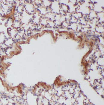 RABGGTA Antibody