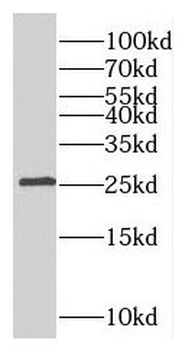 RABL3 Antibody