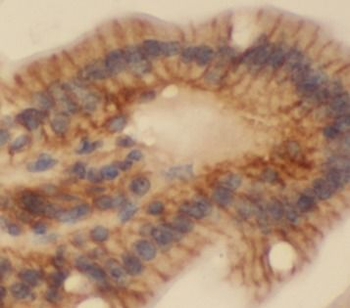 RAC1 Antibody