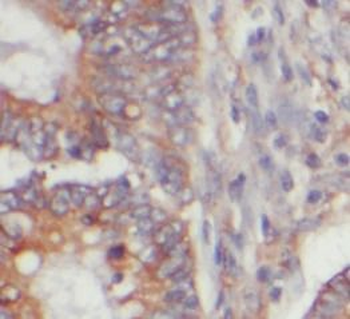 RAC1 Antibody