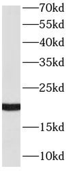 RAC2 Mouse Monoclonal Antibody