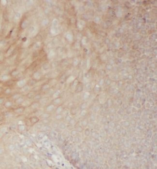 RAC2 Mouse Monoclonal Antibody