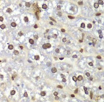 RACK1 Antibody