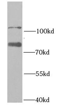 RAD18 Antibody