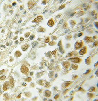 RAD23A Antibody