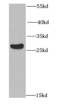RAD9A Antibody