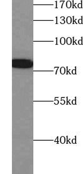 RDX Rabbit Polyclonal Antibody