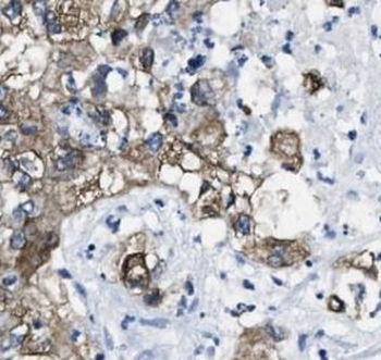 RDX Antibody