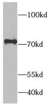 RAF1 Rabbit Polyclonal Antibody