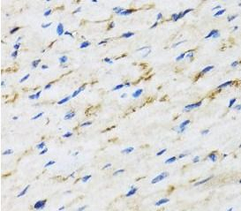 RAF1 Rabbit Polyclonal Antibody