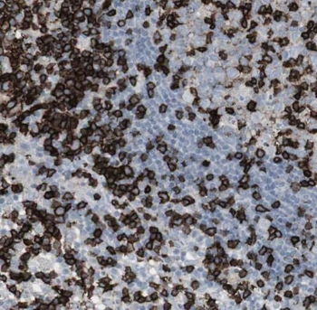 RAG2 Antibody