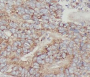 CRADD Antibody