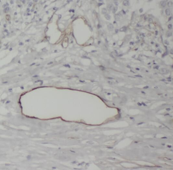RAMP3 Antibody