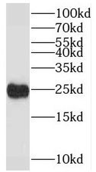 RAN Rabbit Polyclonal Antibody