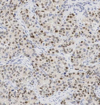 RAN Rabbit Polyclonal Antibody