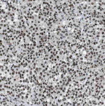 RANBP9 Antibody
