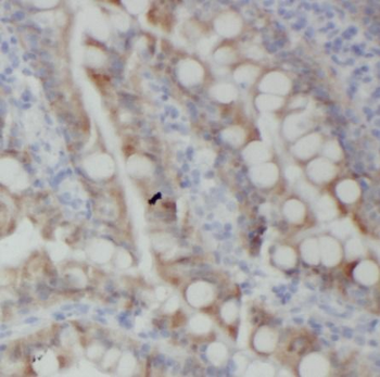 TNFSF11 Rabbit Polyclonal Antibody