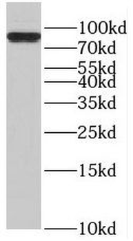 RAP1GAP Antibody