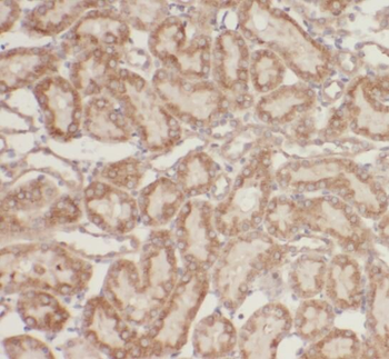 RPTOR Antibody