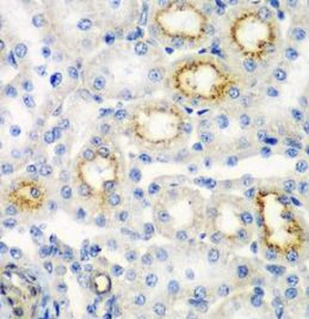 RARRES2 Antibody