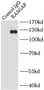RASA1 Antibody