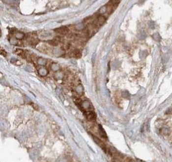 RASA1 Antibody