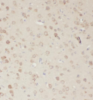 RASGEF1A Antibody