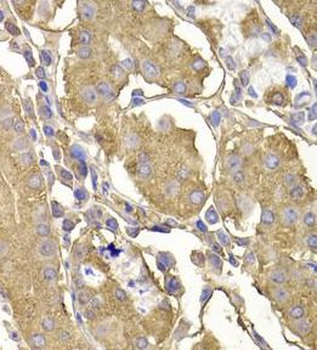 RASGRF1 Antibody