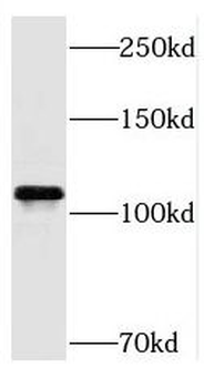 RB1 Rabbit Polyclonal Antibody
