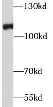 RB1 Rabbit Polyclonal Antibody