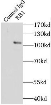 RB1 Rabbit Polyclonal Antibody