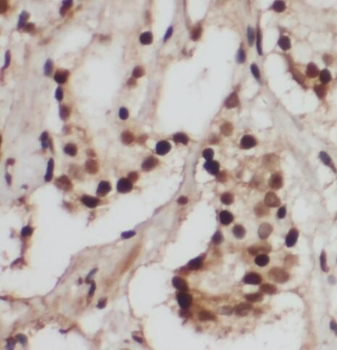 RB1 Rabbit Polyclonal Antibody