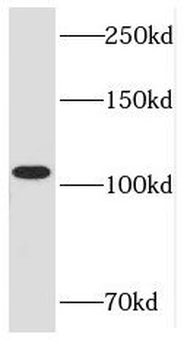 RB1 Rabbit Polyclonal Antibody