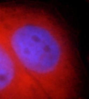 RB1CC1 Antibody