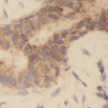 RB1CC1 Antibody
