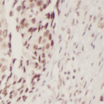 RB1CC1 Antibody