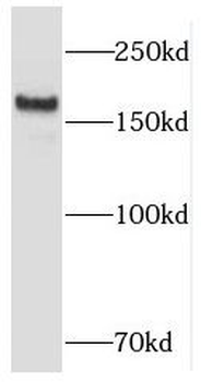 RB1CC1 Antibody