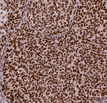 RBBP4 Antibody