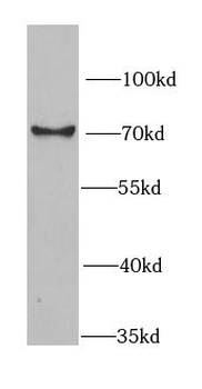 RBBP5 Antibody