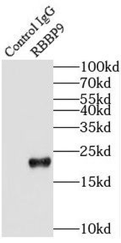 RBBP9 Antibody