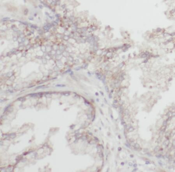 RBBP9 Antibody