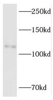 RBM10 Antibody